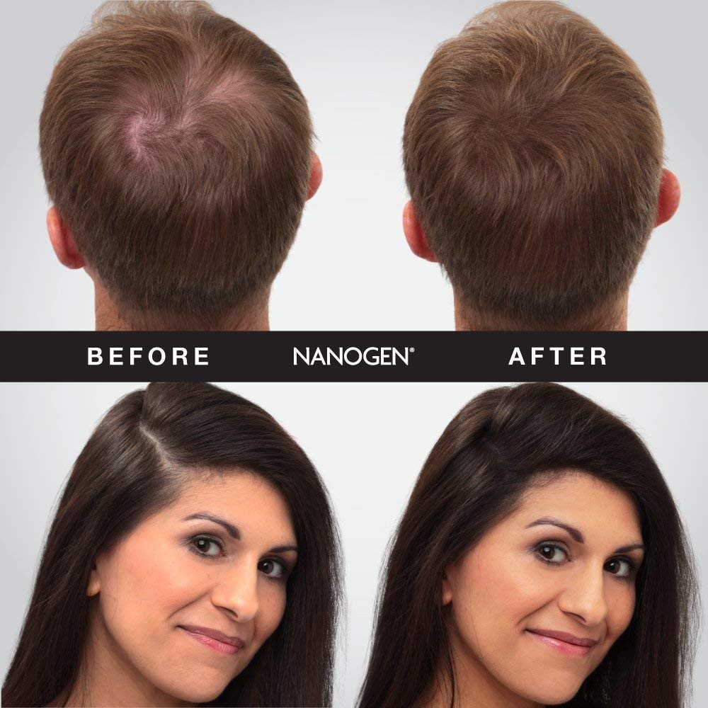 Nanogen Hair Fibres - Dark Brown, 30 g | Keratin Hair Thickener | Unisex 4